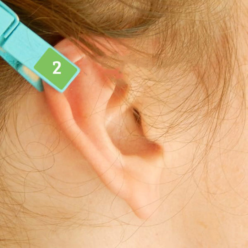 Kulaklarımızdaki ağrı kesici noktalar ile inanılmaz sonuçlar