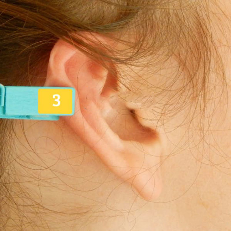 Kulaklarımızdaki ağrı kesici noktalar ile inanılmaz sonuçlar