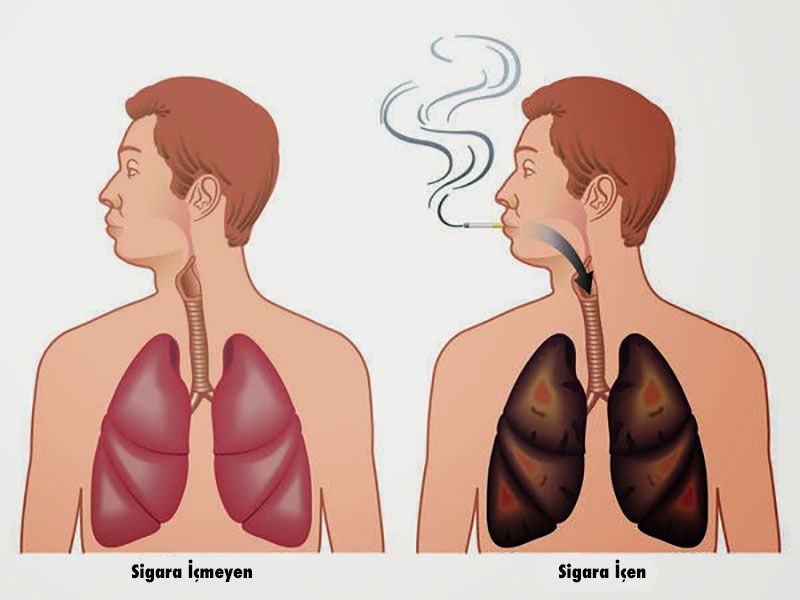 Akciğerleri Temizleme ve Detoks için 5 Yol