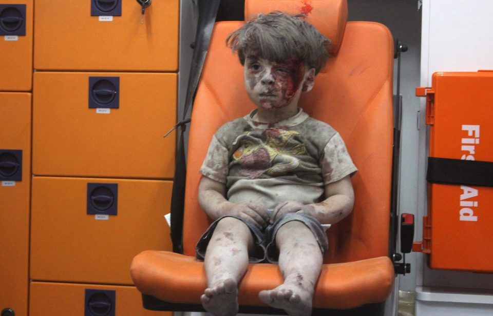 Ambulanstaki kanlı resmiyle dünyayı sarsan Suriyeli çocuk şimdi ne halde?